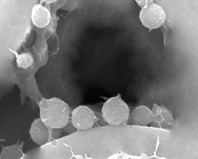 Bacteria in Micro Channel